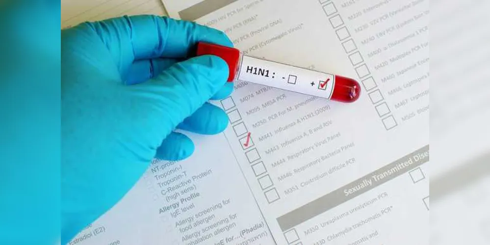 Exames que devem comprovar ou descartar o vírus ficam prontos em cerca de 10 dias.