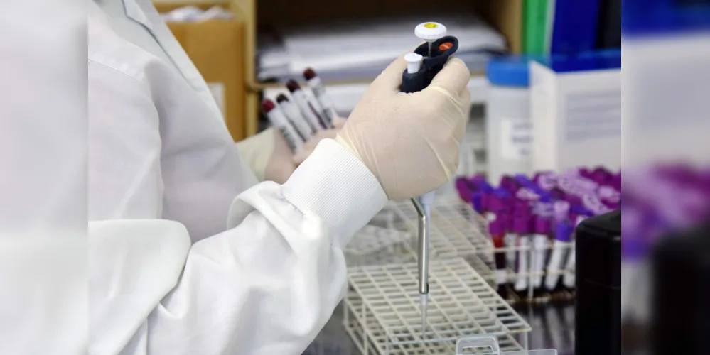 Exames de sangue deram positivo para a doença. Os testes foram realizados no Hospital Nossa Senhora das Graças, na capital do Estado