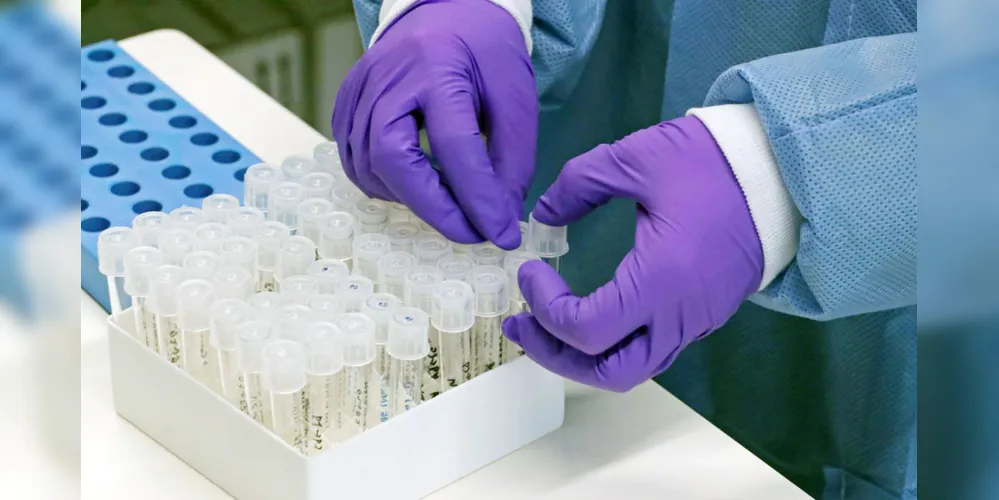 Ministério da Saúde e Secretaria de Estado da Saúde confirmaram as ocorrências através de coletivas nesta quinta-feira (12)