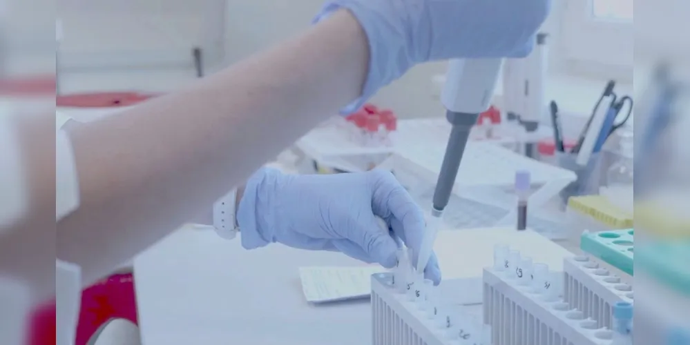 O resultado representou um aumento de 6,2% em relação a ontem(20)